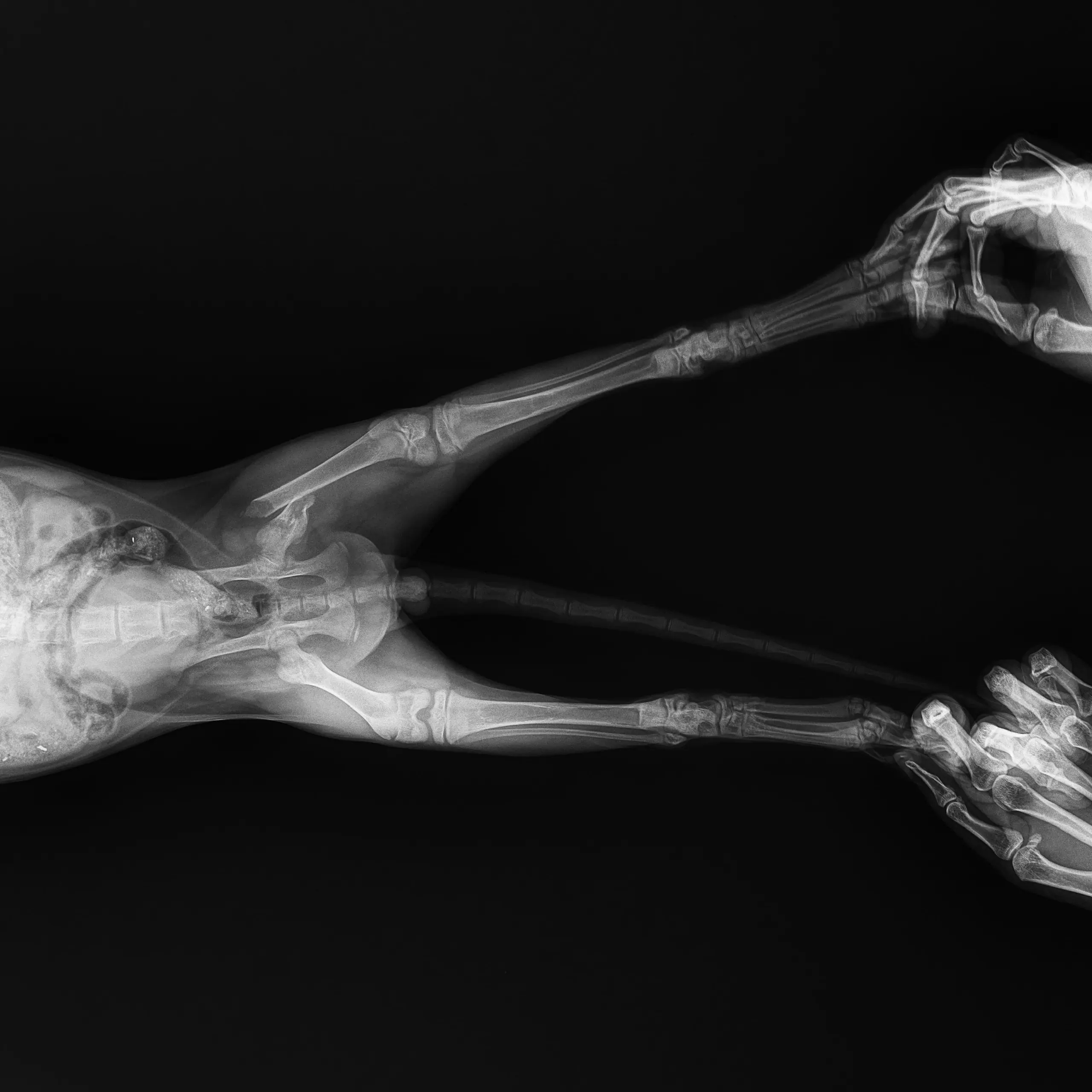 Dịch Vụ Phẩu Xương